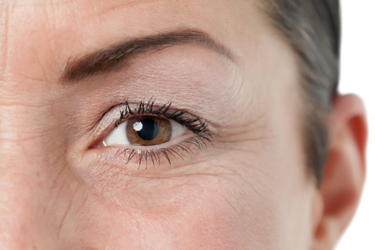 What causes wrinkles? – 5 things you never knew